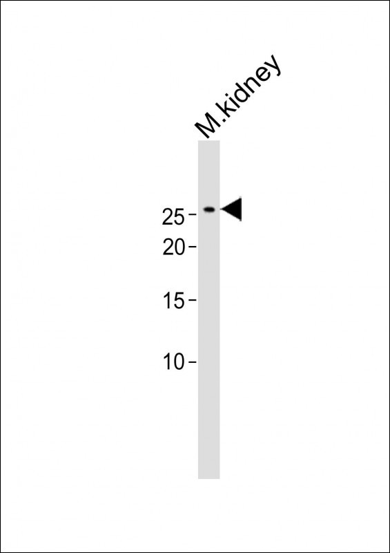 1 - CD8B Antibody (N-term) AP1440a