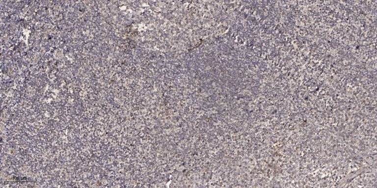 2 - BAGE1 Rabbit Polyclonal Antibody AP93304