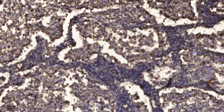 2 - SPR2D Rabbit Polyclonal Antibody AP93316