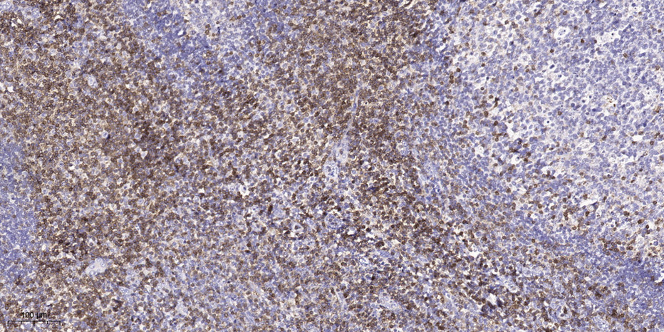 2 - FLNC Rabbit Polyclonal Antibody AP93317