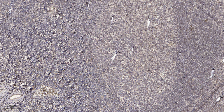 2 - CJ099 Rabbit Polyclonal Antibody AP93323
