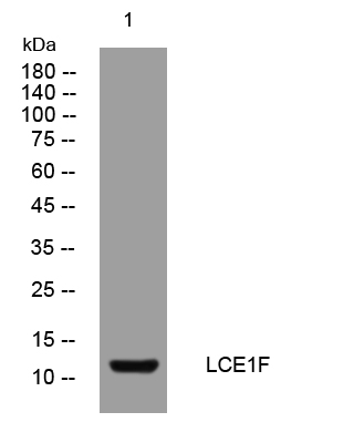 1 - LCE1F Rabbit Polyclonal Antibody AP93324