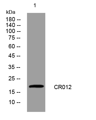1 - CR012 Rabbit Polyclonal Antibody AP93330