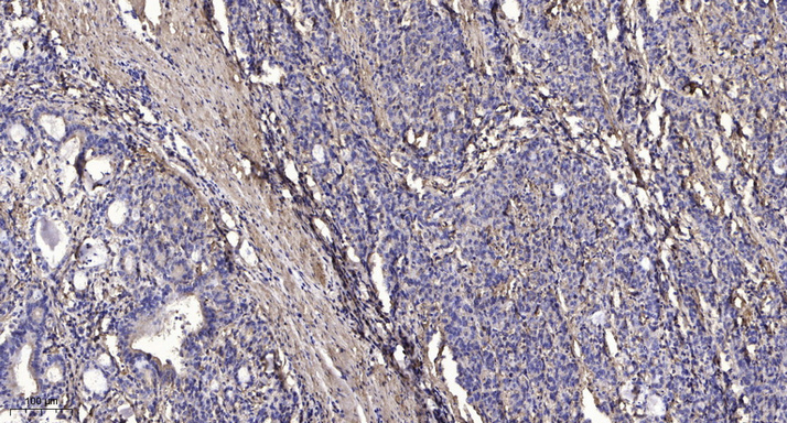 2 - MORN2 Rabbit Polyclonal Antibody AP93335