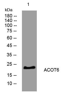 1 - ACOT6 Rabbit Polyclonal Antibody AP93340