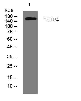 1 - TULP4 Rabbit Polyclonal Antibody AP93343