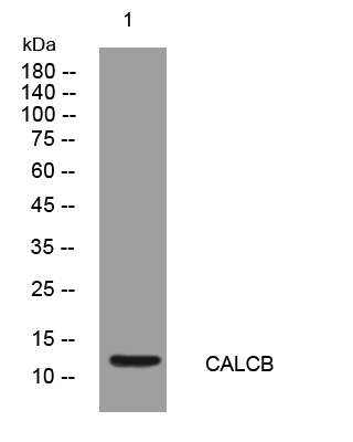 1 - CALCB Rabbit Polyclonal Antibody AP93346