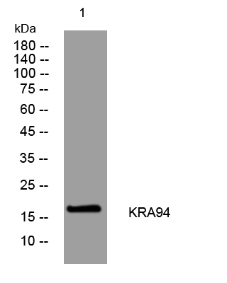 1 - KRA94 Rabbit Polyclonal Antibody AP93355