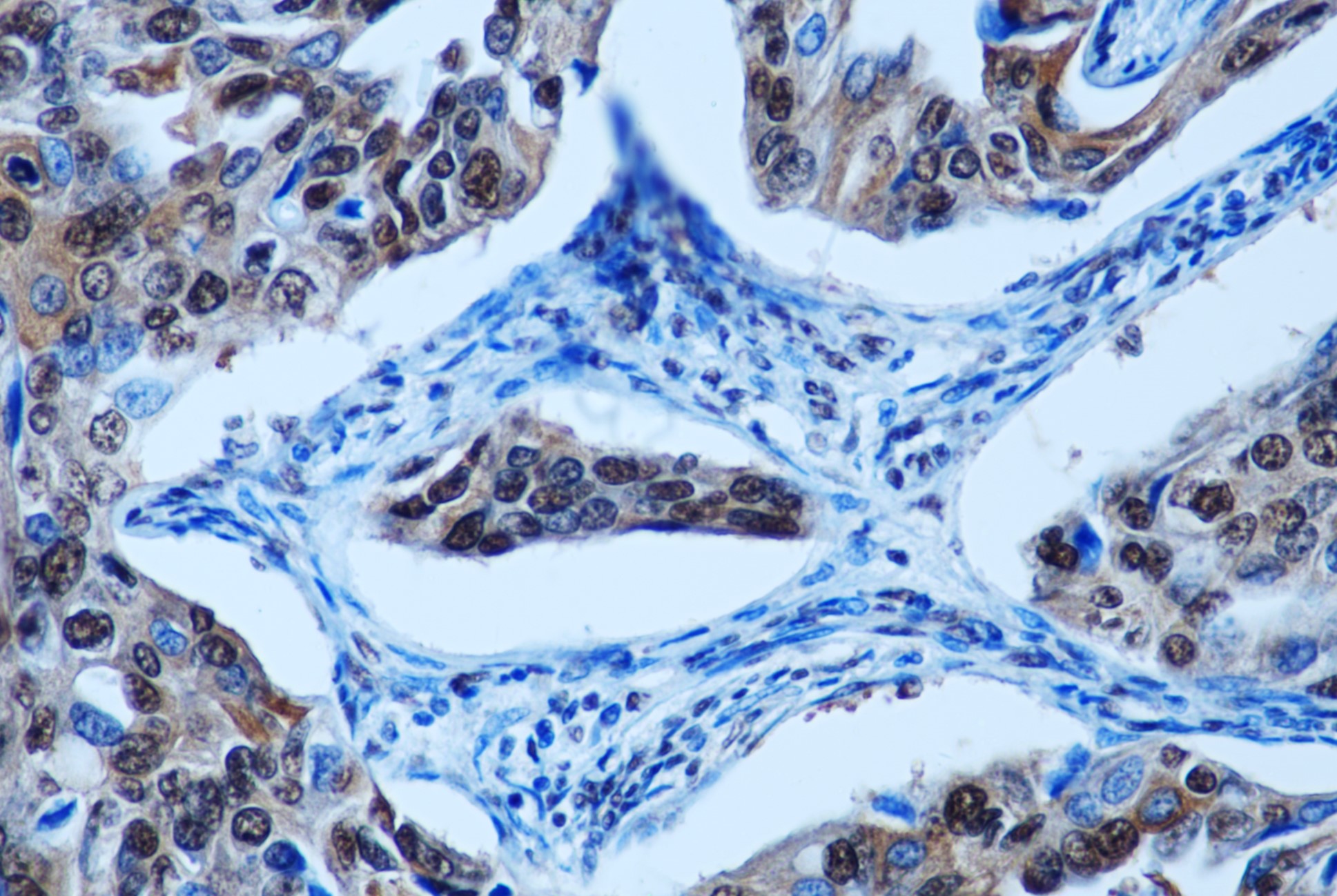 2 - S100 A8 (Mix-mA) Mouse Monoclonal Antibody AP93360