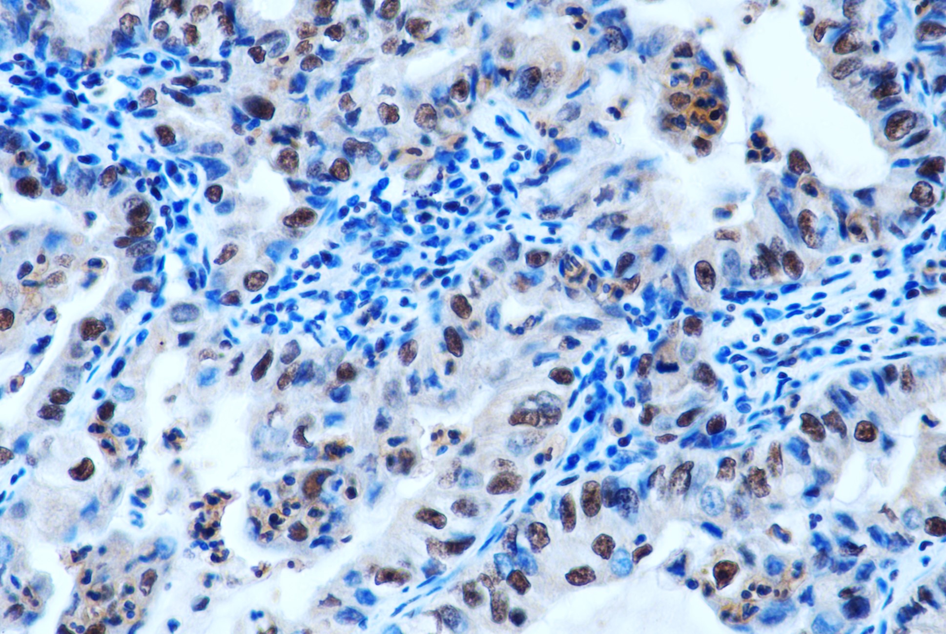 2 - S100 A8+A9 (11C12) Mouse Monoclonal Antibody AP93361