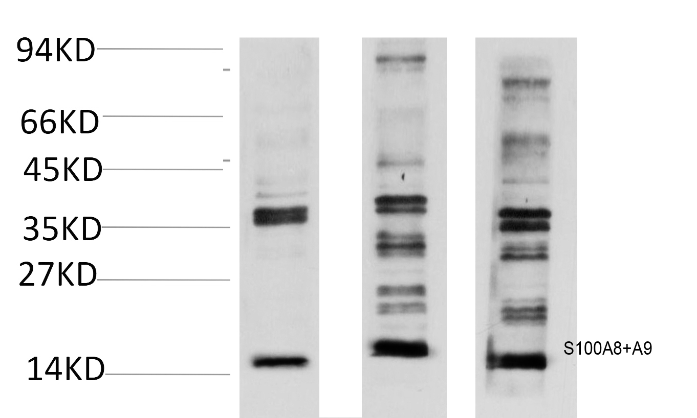 1 - S100 A8+A9 (11C12) Mouse Monoclonal Antibody AP93361