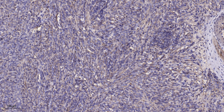2 - WDR87 Rabbit Polyclonal Antibody AP93368