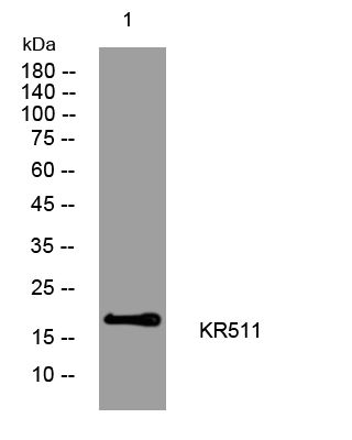 1 - KR511 Rabbit Polyclonal Antibody AP93371