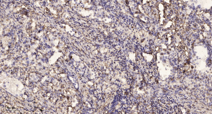 2 - DMP34 Rabbit Polyclonal Antibody AP93378
