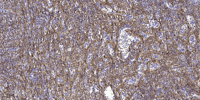2 - LCE3E Rabbit Polyclonal Antibody AP93381