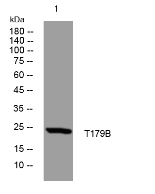1 - T179B Rabbit Polyclonal Antibody AP93395