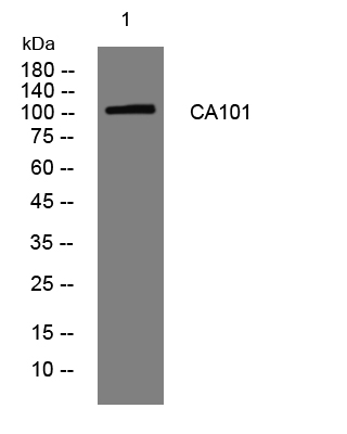 1 - CA101 Rabbit Polyclonal Antibody AP93418