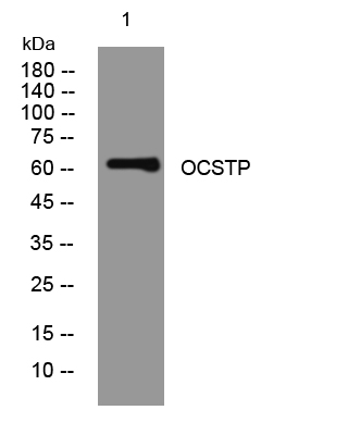 1 - OCSTP Rabbit Polyclonal Antibody AP93424