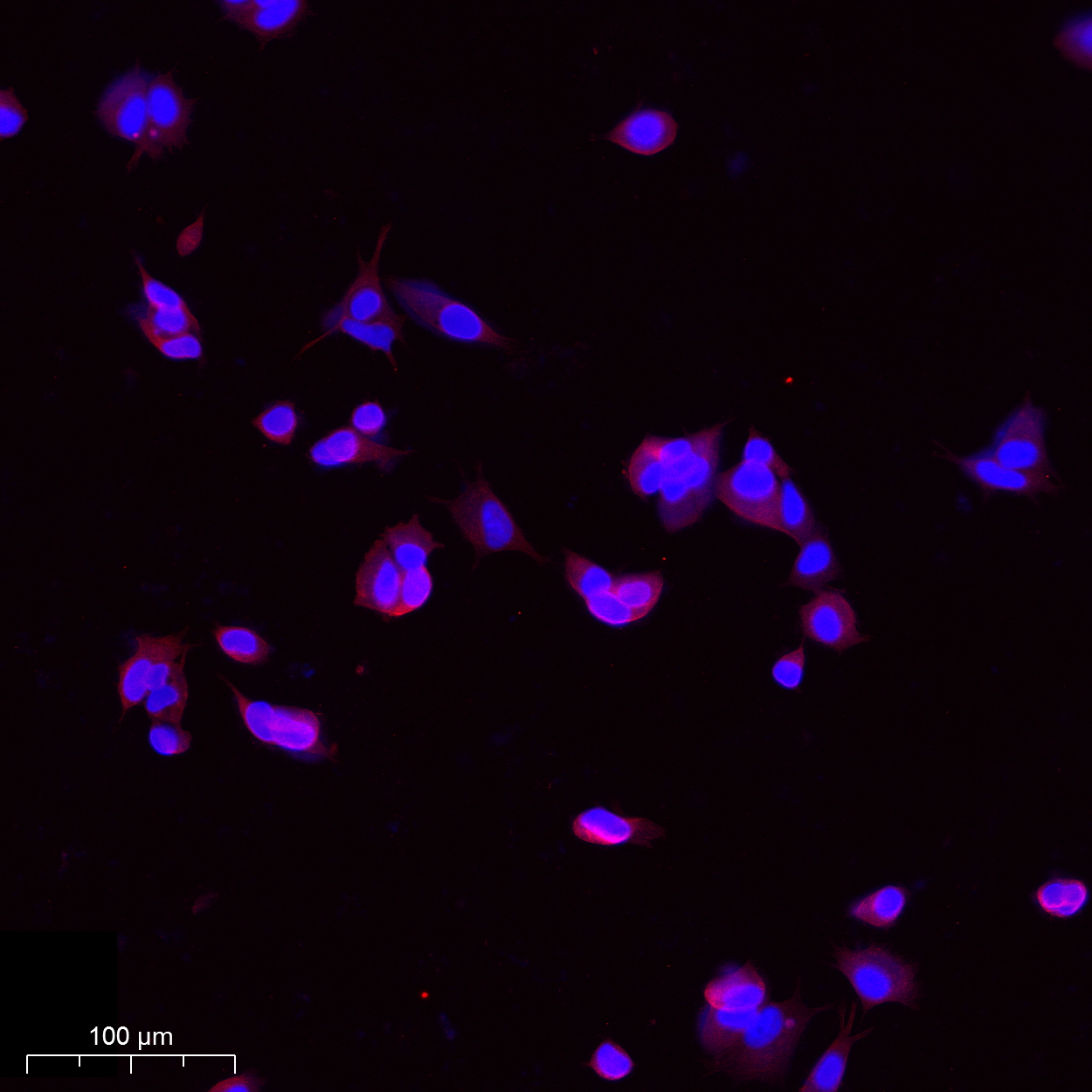 2 - CALCOCO2 Rabbit Polyclonal Antibody AP93440