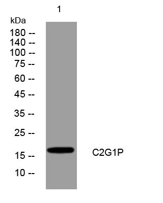 1 - C2G1P Rabbit Polyclonal Antibody AP93444