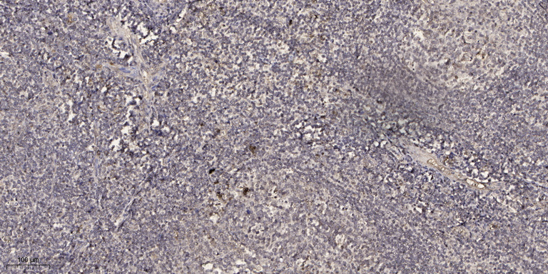 2 - BAGE5 Rabbit Polyclonal Antibody AP93447