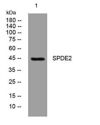 1 - SPDE2 Rabbit Polyclonal Antibody AP93449