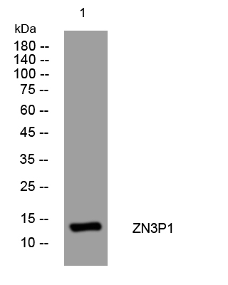 1 - ZN3P1 Rabbit Polyclonal Antibody AP93451