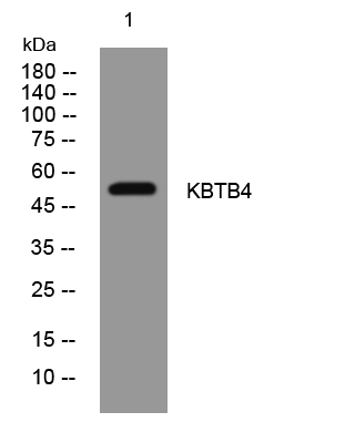 1 - KBTB4 Rabbit Polyclonal Antibody AP93461