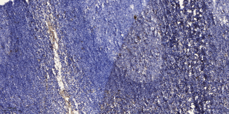 2 - ID2B Rabbit Polyclonal Antibody AP93468