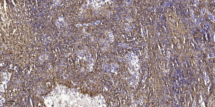 2 - EYS Rabbit Polyclonal Antibody AP93472