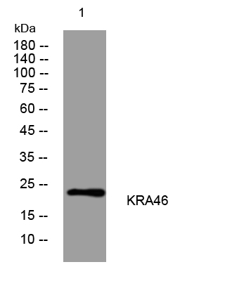 1 - KRA46 Rabbit Polyclonal Antibody AP93477