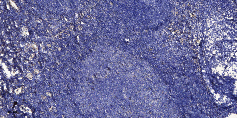 2 - CD006 Rabbit Polyclonal Antibody AP93483