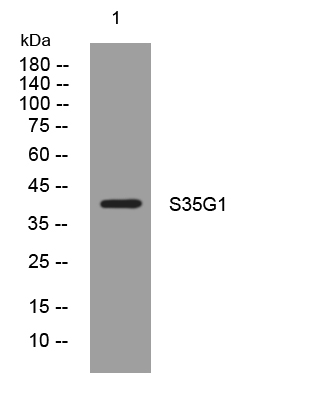 1 - S35G1 Rabbit Polyclonal Antibody AP93495