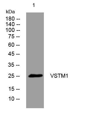 1 - VSTM1 Rabbit Polyclonal Antibody AP93497