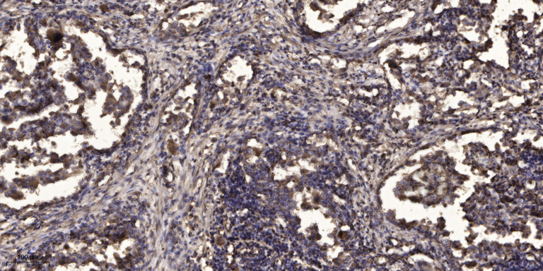 2 - TM14A Rabbit Polyclonal Antibody AP93498