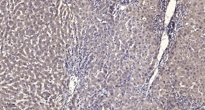 2 - KR222 Rabbit Polyclonal Antibody AP93499