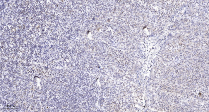 2 - APM2 Rabbit Polyclonal Antibody AP93504