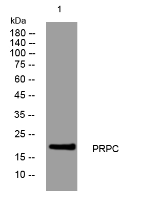 1 - PRPC Rabbit Polyclonal Antibody AP93506
