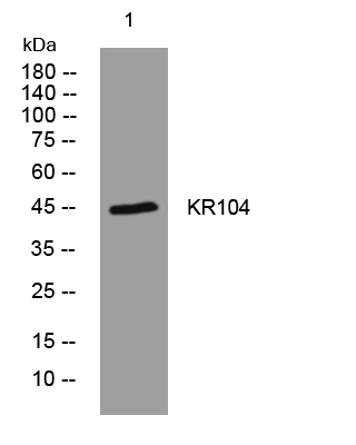 1 - KR104 Rabbit Polyclonal Antibody AP93512