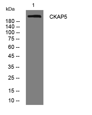 1 - CKAP5 Rabbit Polyclonal Antibody AP93519