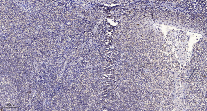 2 - CK010 Rabbit Polyclonal Antibody AP93522
