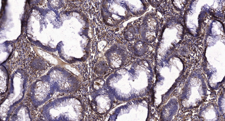 2 - CA212 Rabbit Polyclonal Antibody AP93529
