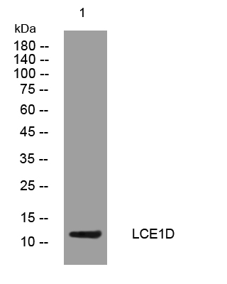 1 - LCE1D Rabbit Polyclonal Antibody AP93530
