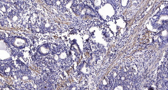 2 - LCE1D Rabbit Polyclonal Antibody AP93530