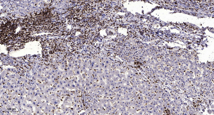 2 - MICA1 Rabbit Polyclonal Antibody AP93536