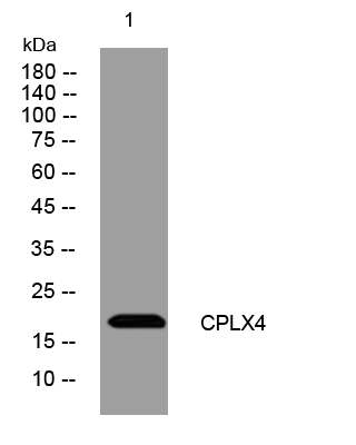 1 - CPLX4 Rabbit Polyclonal Antibody AP93541