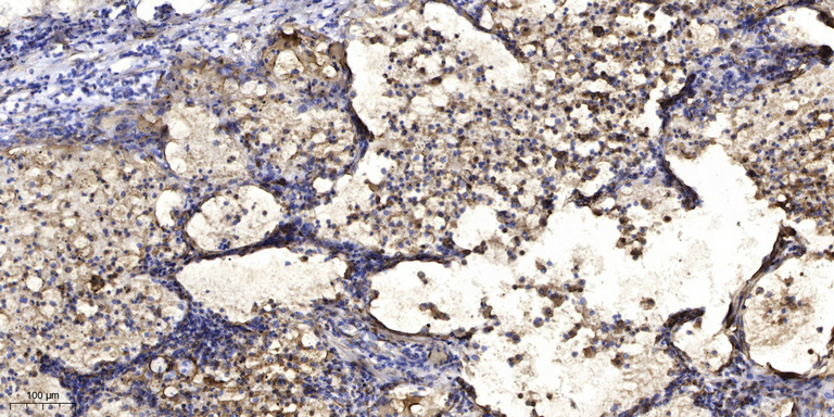 2 - KISHA Rabbit Polyclonal Antibody AP93545