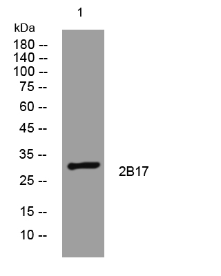 1 - 2B17 Rabbit Polyclonal Antibody AP93547