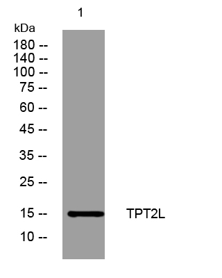 1 - TPT2L Rabbit Polyclonal Antibody AP93557