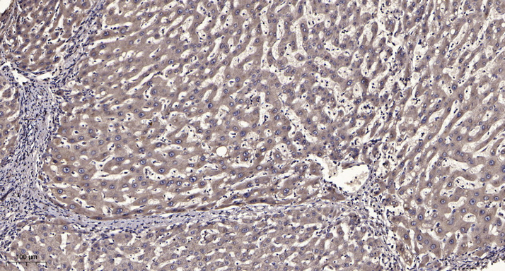 2 - KISHB Rabbit Polyclonal Antibody AP93560